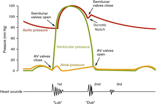 Illustration of First Heart Sound S1 S3 S4 Atrial Myxoma Papillary Fibroelastoma Tuberculous Pericarditis Constrictive Pericarditis Complete Guide symptoms