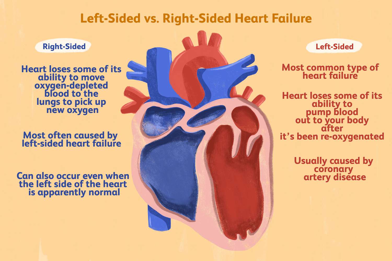 Illustration of Congestive Heart Failure Comprehensive Guide Diagnosis Classification and Management symptoms