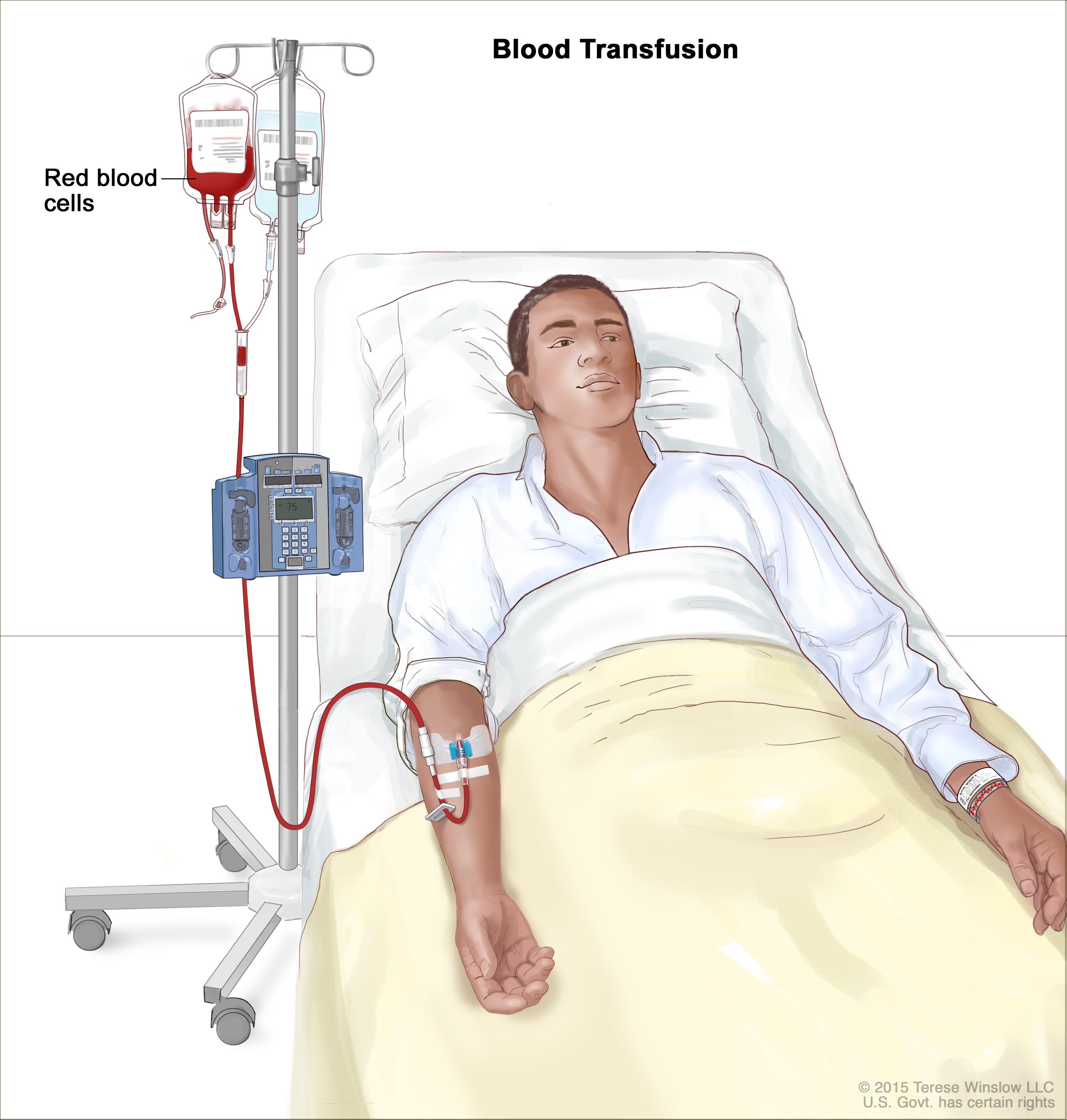Illustration of Blood Transfusion and Massive Blood Transfusion Protocol Complete Clinical Guide symptoms