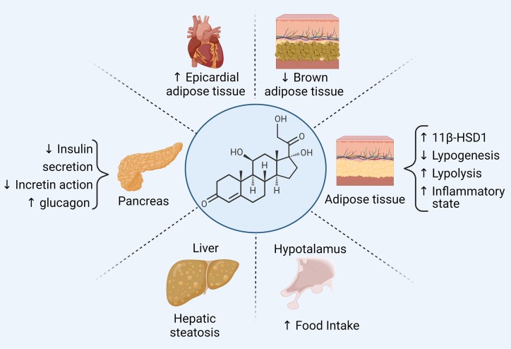 Illustration of Cushing Syndrome Comprehensive Clinical Guide Diagnosis Causes and Management symptoms